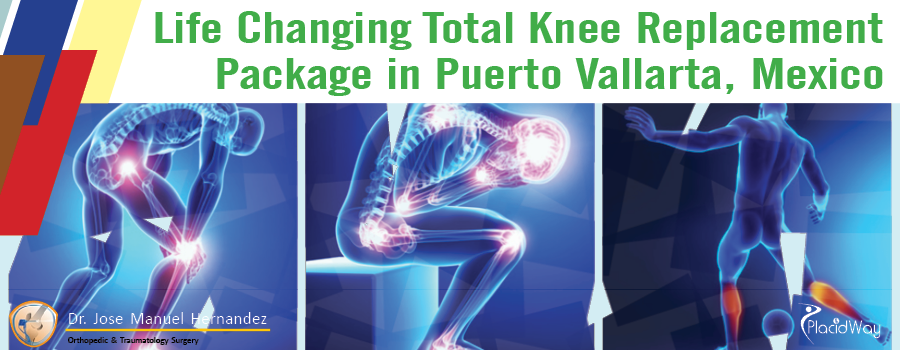 Package for Total Knee Replacement in Puerto Vallarta, Mexico